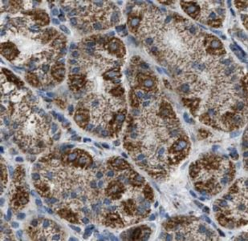 GRP Rabbit Polyclonal Antibody