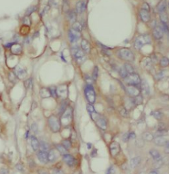 RANGRF Rabbit Polyclonal Antibody