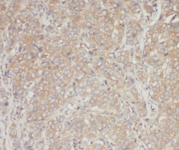 ARHGDIA Rabbit Polyclonal Antibody