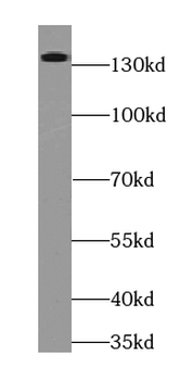 RIMS2 Specific Rabbit Polyclonal Antibody