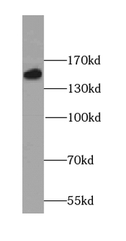 ROCK1 Specific Rabbit Polyclonal Antibody