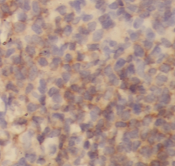 ROCK1 Specific Rabbit Polyclonal Antibody