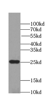 POLR2E Rabbit Polyclonal Antibody