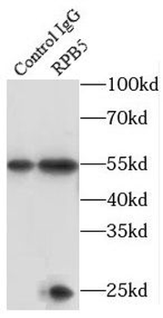 POLR2E Rabbit Polyclonal Antibody