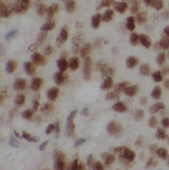 POLR2E Rabbit Polyclonal Antibody