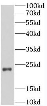SELENOS Rabbit Polyclonal Antibody