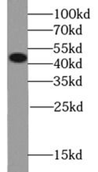 SEMG1 Rabbit Polyclonal Antibody
