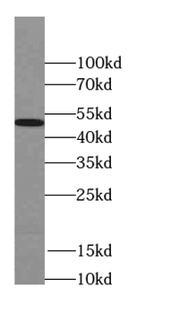 SEPTIN11 Rabbit Polyclonal Antibody
