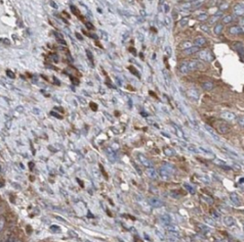 SEPTIN11 Rabbit Polyclonal Antibody