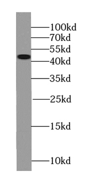 SEPTIN2 Rabbit Polyclonal Antibody