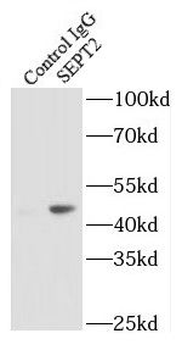 SEPTIN2 Rabbit Polyclonal Antibody