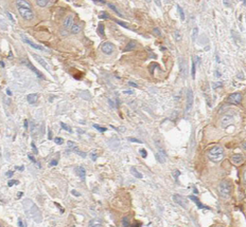 SEPTIN2 Rabbit Polyclonal Antibody