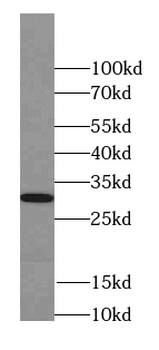SEPTIN4 Rabbit Polyclonal Antibody