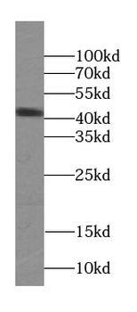 SEPTIN5 Rabbit Polyclonal Antibody