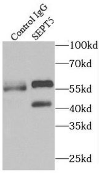 SEPTIN5 Rabbit Polyclonal Antibody