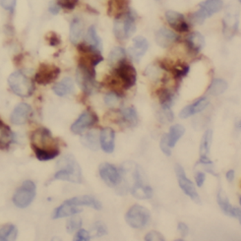 SEPTIN5 Rabbit Polyclonal Antibody