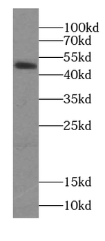 SEPTIN6 Rabbit Polyclonal Antibody