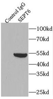 SEPTIN6 Rabbit Polyclonal Antibody