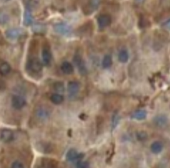SEPTIN6 Rabbit Polyclonal Antibody