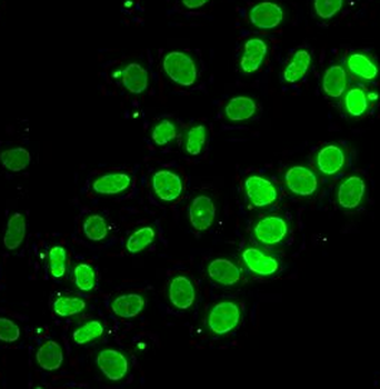 SEPTIN7 Rabbit Polyclonal Antibody