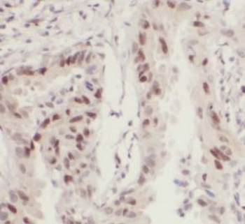 SEPTIN7 Rabbit Polyclonal Antibody