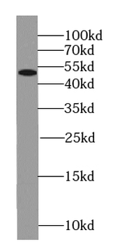 SEPTIN8 Rabbit Polyclonal Antibody