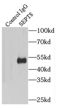 SEPTIN8 Rabbit Polyclonal Antibody