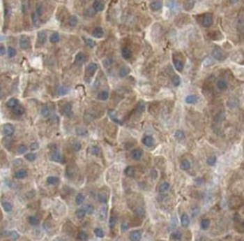 SEPTIN8 Rabbit Polyclonal Antibody