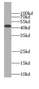 SIRT2 Specific Rabbit Polyclonal Antibody