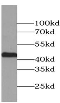 ACTA2 Rabbit Polyclonal Antibody
