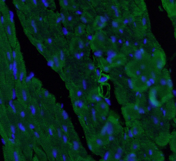 ACTA2 Rabbit Polyclonal Antibody