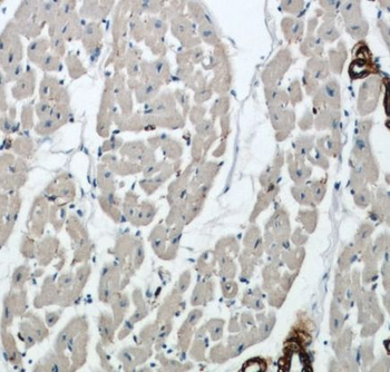 ACTA2 Rabbit Polyclonal Antibody