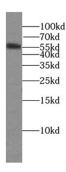 SMYD1 Rabbit Polyclonal Antibody