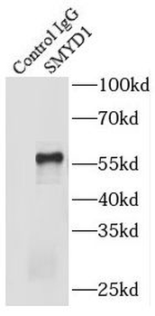 SMYD1 Rabbit Polyclonal Antibody