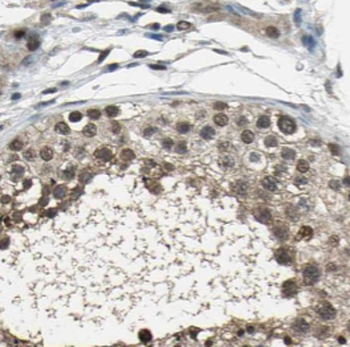 SMYD1 Rabbit Polyclonal Antibody