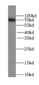 SLC5A5 Rabbit Polyclonal Antibody