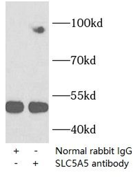 SLC5A5 Rabbit Polyclonal Antibody