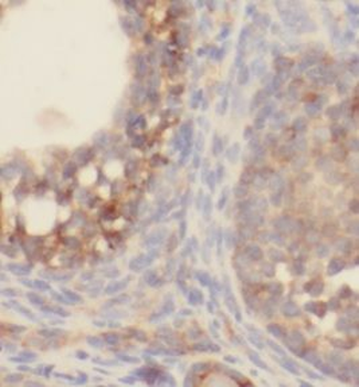 SLC5A5 Rabbit Polyclonal Antibody