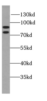 SPART Rabbit Polyclonal Antibody