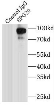 SPART Rabbit Polyclonal Antibody