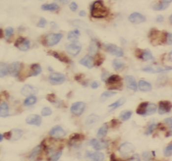 SPART Rabbit Polyclonal Antibody