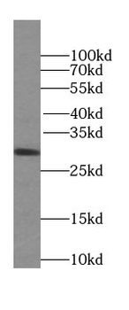 SPIN1 Specific Rabbit Polyclonal Antibody
