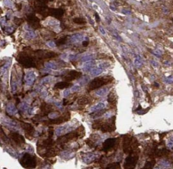 SPIN1 Specific Rabbit Polyclonal Antibody