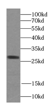 STARD3NL Rabbit Polyclonal Antibody
