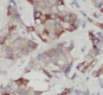 STARD3NL Rabbit Polyclonal Antibody