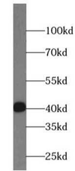 STBD1 Rabbit Polyclonal Antibody