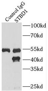 STBD1 Rabbit Polyclonal Antibody