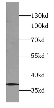 SYNPR Rabbit Polyclonal Antibody