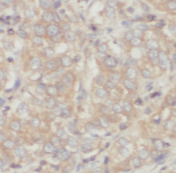 SYNPR Rabbit Polyclonal Antibody
