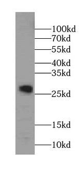 STX8 Rabbit Polyclonal Antibody